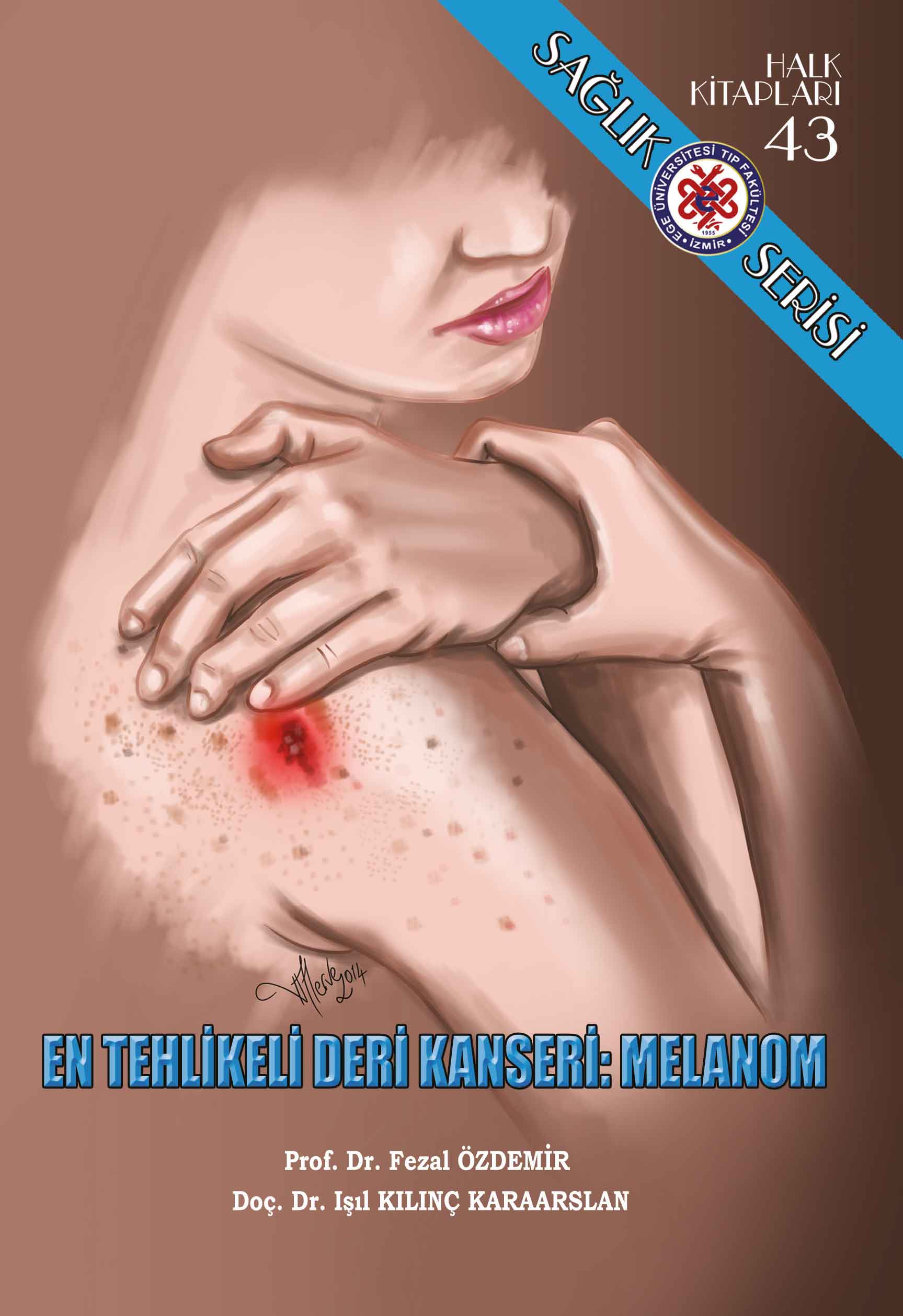 En Tehlikeli Deri Kanseri: Melanom