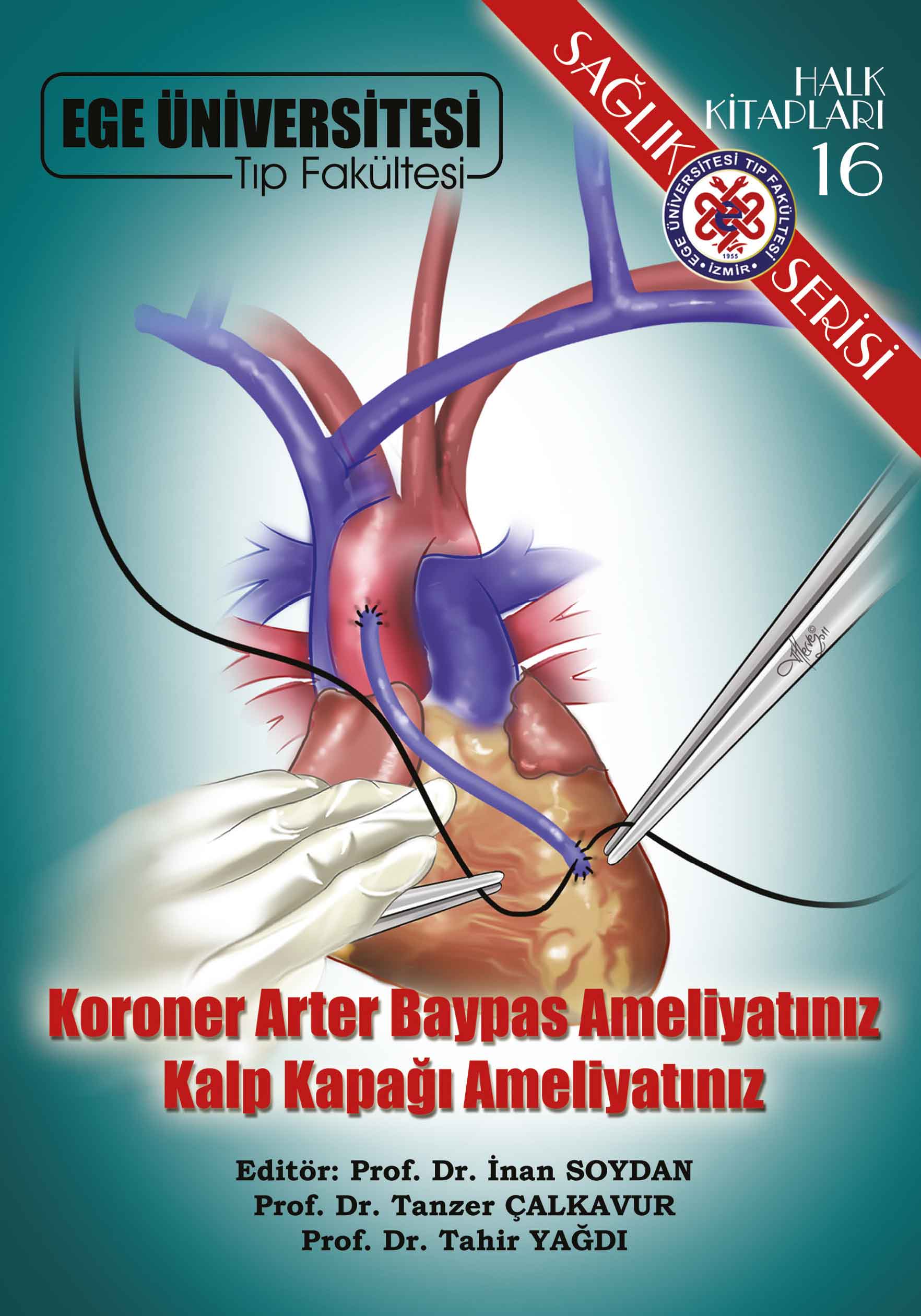 Mitral Kapak Sarkması Nedir? Koroner Arter Baypas Ameliyatınız Kalp Kapağı Ameliyatınız