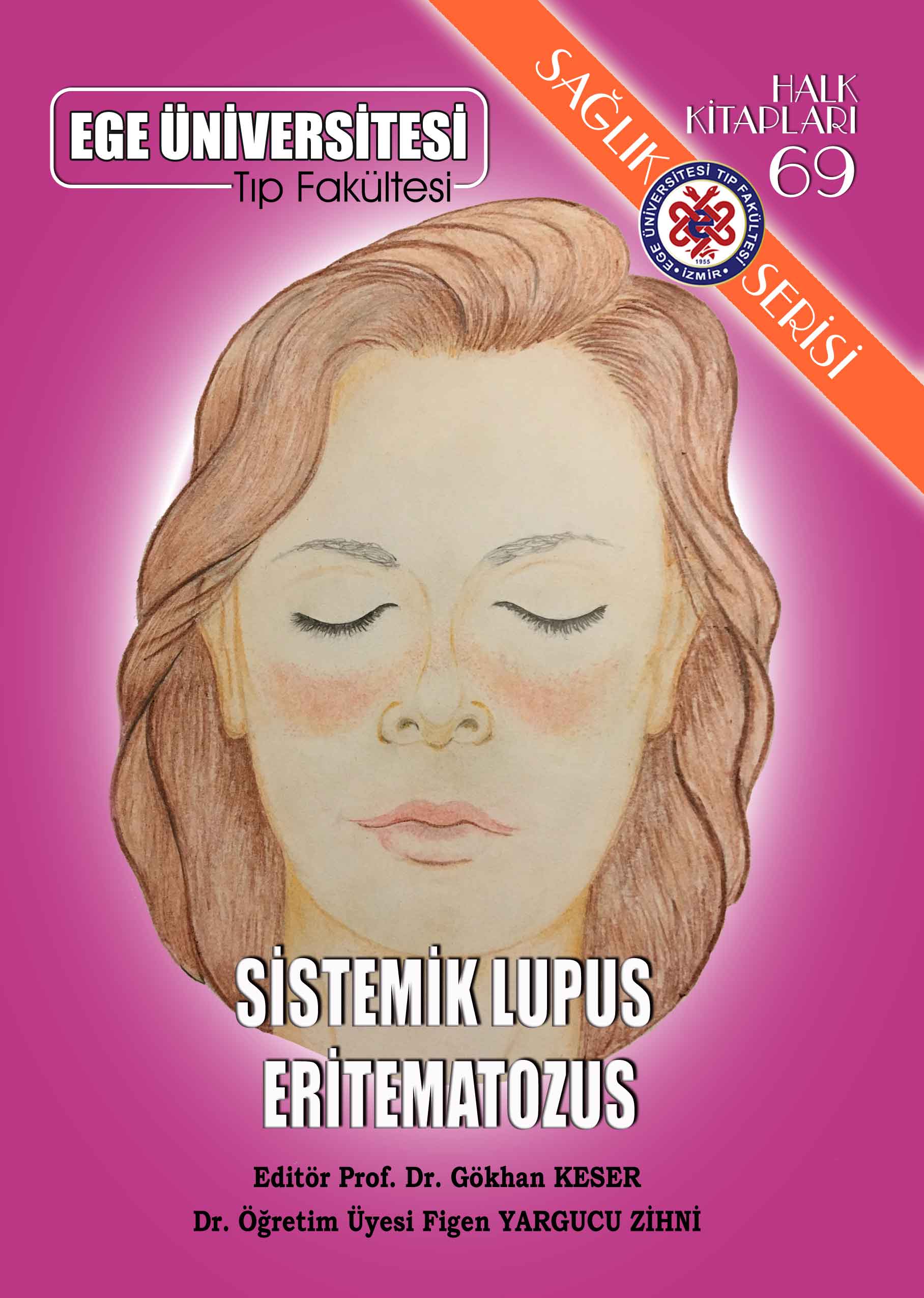 Sistemik Lupus Eritematozus